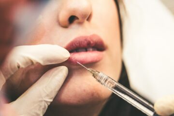 What You Should Know About Dermal Fillers in 2025